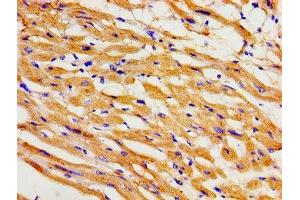 Immunohistochemistry of paraffin-embedded human heart tissue using ABIN7163993 at dilution of 1:100 (KCNH2 antibody  (AA 894-1137))