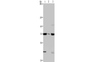 Gel: 6 % SDS-PAGE, Lysate: 40 μg, Lane 1-3: LoVo cells, human testis tissue, A549 cells, Primary antibody: ABIN7129423(FAAH Antibody) at dilution 1/400, Secondary antibody: Goat anti rabbit IgG at 1/8000 dilution, Exposure time: 2 minutes (FAAH antibody)
