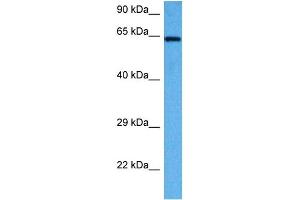 Host:  Rabbit  Target Name:  AIFM1  Sample Tissue:  Mouse Liver  Antibody Dilution:  1ug/ml
