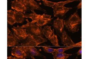 Immunofluorescence analysis of C6 cells using ITSN2 Polyclonal Antibody at dilution of 1:100. (Intersectin 2 antibody)