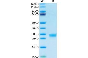 Mouse IL-2 on Tris-Bis PAGE under reduced condition. (IL-2 Protein (AA 21-169) (His-Avi Tag))