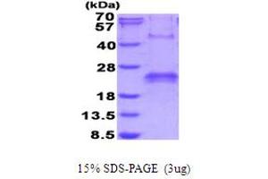 SDS-PAGE (SDS) image for VEGF 165 (AA 1-191) protein (His tag) (ABIN6387506) (VEGF 165 (AA 1-191) protein (His tag))