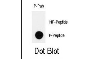 Dot Blot (DB) image for anti-Homeodomain Interacting Protein Kinase 2 (HIPK2) (pTyr361) antibody (ABIN3001890)