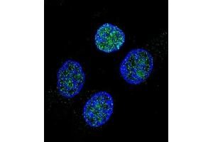 Confocal immunofluorescent analysis of PROC Antibody (Center) (ABIN657466 and ABIN2846494) with Hela cell followed by Alexa Fluor 488-conjugated goat anti-rabbit lgG (green). (PROC antibody  (AA 177-206))