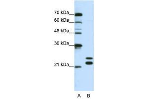 CSDC2 antibody used at 0. (CSDC2 antibody  (N-Term))