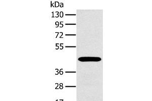 Western Blot analysis of A375 cell using MAGEA10 Polyclonal Antibody at dilution of 1:400 (MAGEA10 antibody)
