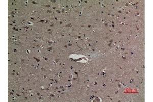 Immunohistochemistry (IHC) analysis of paraffin-embedded Human Brain, antibody was diluted at 1:100. (HMGB1 antibody  (acLys12))