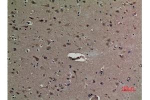 Immunohistochemistry (IHC) analysis of paraffin-embedded Human Brain, antibody was diluted at 1:100. (HMGB1 antibody  (acLys12))