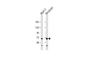 All lanes : Anti-FOXO3 Antibody (N-term) at 1:1000 dilution Lane 1: MCF-7 whole cell lysate Lane 2: SH-SY5Y whole cell lysate Lysates/proteins at 20 μg per lane.