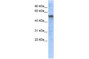 WB Suggested Anti-TPH2 Antibody Titration:  0. (Tryptophan Hydroxylase 2 antibody  (Middle Region))