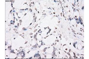 Image no. 2 for anti-Checkpoint Kinase 2 (CHEK2) antibody (ABIN1497499) (CHEK2 antibody)