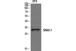 Western Blotting (WB) image for anti-SNAIL (SNAI1) (Tyr1102) antibody (ABIN3177452) (SNAIL antibody  (Tyr1102))