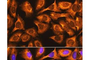 Immunofluorescence analysis of U-2 OS cells using RPS3 Polyclonal Antibody at dilution of 1:100. (RPS3 antibody)
