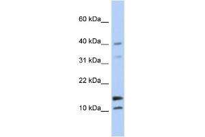 WB Suggested Anti-WFDC5 Antibody Titration: 0. (WFDC5 antibody  (N-Term))