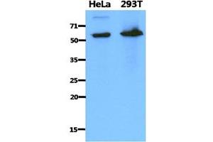 The cell lysates of HeLa (40ug) and 293T (40ug) were resolved by SDS-PAGE, transferred to PVDF membrane and probed with anti-human PDZK1 antibody (1:1000). (PDZK1 antibody)