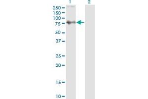 Western Blot analysis of SKIL expression in transfected 293T cell line by SKIL monoclonal antibody (M01), clone 1C12. (SKIL antibody  (AA 236-313))