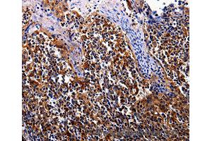 Immunohistochemistry of Human tosil  using IL17RC Polyclonal Antibody at dilution of 1:30