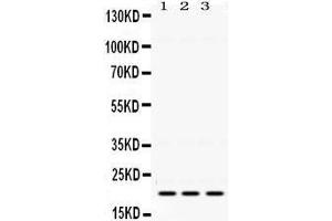 Western Blotting (WB) image for anti-HRas proto-oncogene, GTPase (HRAS) (AA 101-137), (C-Term) antibody (ABIN3043845) (HRAS antibody  (C-Term))