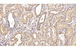 Detection of CEACAM1 in Human Kidney Tissue using Monoclonal Antibody to Carcinoembryonic Antigen Related Cell Adhesion Molecule 1 (CEACAM1) (CEACAM1 antibody)