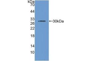 Figure. (RNPEP antibody  (AA 388-616))