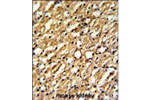 Formalin-fixed and paraffin-embedded mouse kidney reacted with DDAH1 Antibody , which was peroxidase-conjugated to the secondary antibody, followed by DAB staining. (DDAH1 antibody  (C-Term))