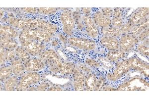 Detection of SOD1 in Human Kidney Tissue using Polyclonal Antibody to Superoxide Dismutase 1 (SOD1) (SOD1 antibody  (AA 2-154))