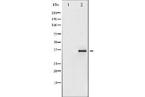 Western Blotting (WB) image for anti-Nuclear Factor of kappa Light Polypeptide Gene Enhancer in B-Cells Inhibitor, epsilon (NFKBIE) (pSer161) antibody (ABIN6255101)