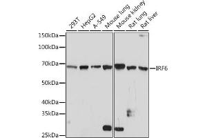 Western blot analysis of extracts of various cell lines, using IRF6 Rabbit mAb (ABIN1680921, ABIN3017588, ABIN3017589 and ABIN7101507) at 1:1000 dilution.
