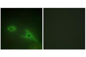 Immunofluorescence (IF) image for anti-Ephrin Type A Receptor 1 (EPHA1) (Internal Region) antibody (ABIN1849246)