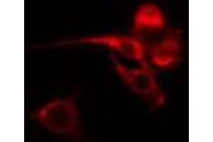 ABIN6274583 staining HT29 cells by IF/ICC. (ADRB1 antibody  (Internal Region))