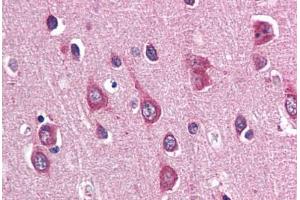 Human Brain, Cortex (formalin-fixed, paraffin-embedded) stained with PAK3 antibody ABIN337352 at 10 ug/ml followed by biotinylated goat anti-rabbit IgG secondary antibody ABIN481713, alkaline phosphatase-streptavidin and chromogen. (PAK3 antibody  (N-Term))