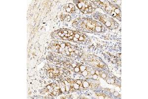 Immunohistochemistry of paraffin embedded rat duodenum using TAF4 (ABIN7075827) at dilution of 1:450 (300x lens) (TAF4 antibody)