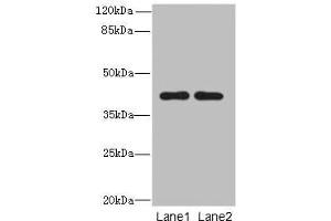 Western blot All lanes: CIPC antibody at 6 μg/mL Lane 1: A431 whole cell lysate Lane 2: NIH/3T3 whole cell lysate Secondary Goat polyclonal to rabbit IgG at 1/10000 dilution Predicted band size: 43 kDa Observed band size: 43 kDa (CIPC/KIAA1737 antibody  (AA 1-399))