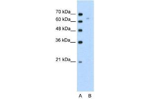WB Suggested Anti-TOX  Antibody Titration: 0. (TOX antibody  (N-Term))