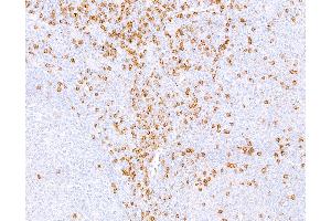Immunohistochemistry (IHC) image for anti-CD8a Molecule (CD8A) (C-Term), (Cytoplasmic Domain) antibody (ABIN7449043) (CD8 alpha antibody  (C-Term, Cytoplasmic Domain))