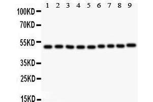 Western Blotting (WB) image for anti-Myc Proto-Oncogene protein (MYC) (AA 257-439) antibody (ABIN3043598) (c-MYC antibody  (AA 257-439))