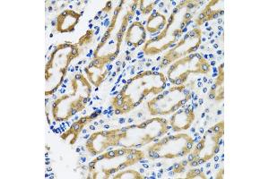 Immunohistochemistry of paraffin-embedded rat kidney using SLC23A2 antibody (ABIN5974077) at dilution of 1/100 (40x lens). (SLC23A2 antibody)