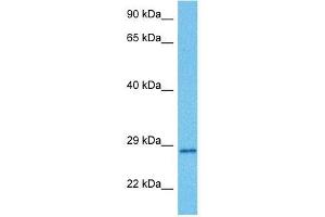 Host:  Mouse  Target Name:  MLX  Sample Tissue:  Mouse Small Intestine  Antibody Dilution:  1ug/ml (MLX antibody  (C-Term))
