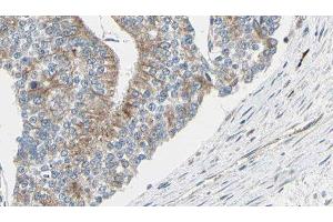 ABIN6276977 at 1/100 staining Human prostate tissue by IHC-P. (TCP1 alpha/CCTA antibody  (C-Term))
