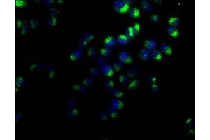 Immunofluorescence staining of Hela cells with ABIN7147175 at 1:50, counter-stained with DAPI. (CD63 antibody  (AA 103-203))
