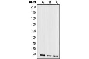 Western blot analysis of Mammaglobin A expression in MCF7 (A), MDAMB435 (B), HeLa (C), HepG2 (D) whole cell lysates.
