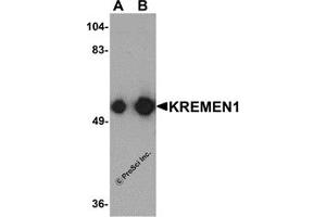 Western Blotting (WB) image for anti-Kringle Containing Transmembrane Protein 1 (KREMEN1) (C-Term) antibody (ABIN1077451) (KREMEN1 antibody  (C-Term))
