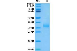 Human Siglec-15 on Tris-Bis PAGE under reduced condition. (SIGLEC15 Protein (AA 20-263) (His-Avi Tag))