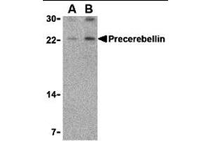 Western Blotting (WB) image for anti-Cerebellin 1 Precursor (CBLN1) (Middle Region) antibody (ABIN1031046) (CBLN1 antibody  (Middle Region))