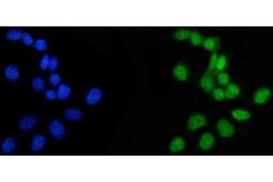 IF analysis of APRT using anti-APRT antibody (ABIN4886471).