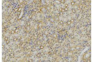 ABIN6279615 at 1/100 staining Mouse kidney tissue by IHC-P.