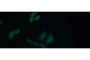 Detection of HSPA1B in Human HepG2 cell using Polyclonal Antibody to Heat Shock 70 kDa Protein 1B (HSPA1B) (HSPA1B antibody  (AA 1-642))