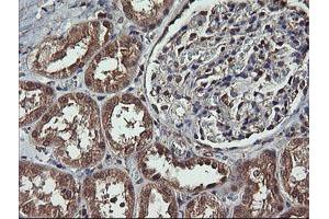 Image no. 2 for anti-Mitogen-Activated Protein Kinase Kinase 1 (MAP2K1) antibody (ABIN1499394) (MEK1 antibody)