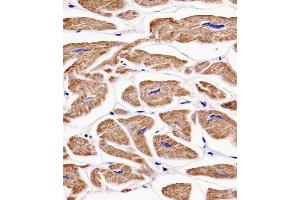 (ABIN6242395 and ABIN6577138) staining MKRN2 in human heart tissue sections by Immunohistochemistry (IHC-P - paraformaldehyde-fixed, paraffin-embedded sections). (MKRN2 antibody)