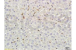 Formalin-fixed and paraffin embedded rat liver labeled with Rabbit Anti-phospho-CD32B(Tyr292) Polyclonal Antibody (ABIN761411) at 1:200 followed by conjugation to the secondary antibody and DAB staining. (FCGR2B antibody  (pTyr292))